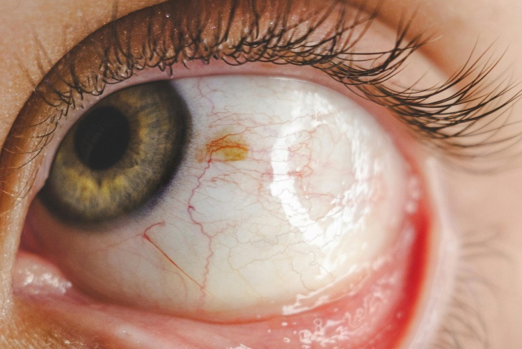 Snapshot of an eye.